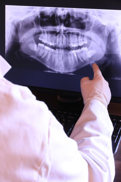 Best Emergency Broken Tooth Repair in Redington Shores, FL